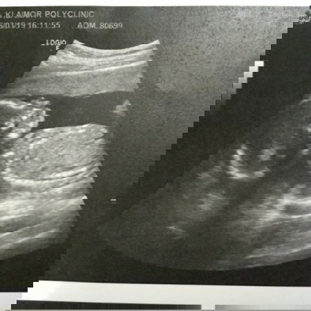 อีก 4 เดือน