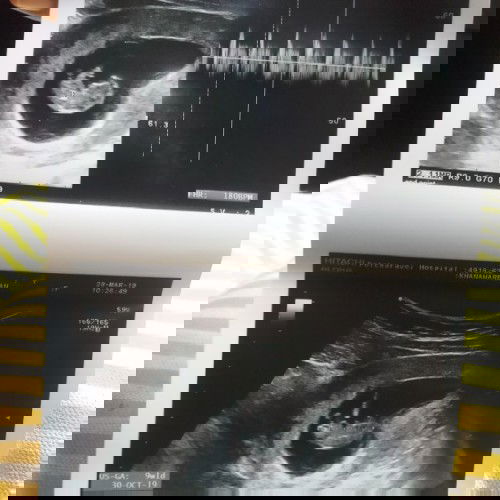 เจอน้องแล้ว ค้ะ