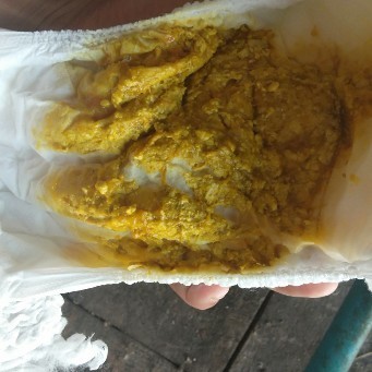 ลูกถ่ายแบบนี้ปกติไหม???