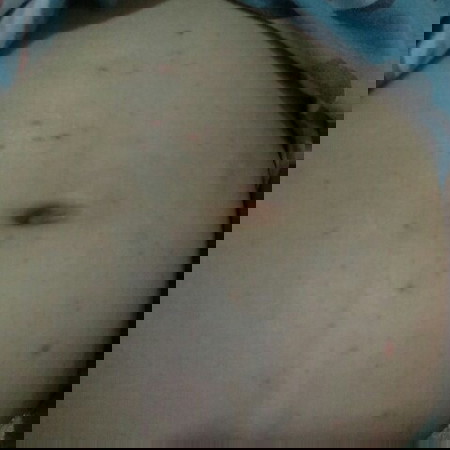 แนะนำครีมทาท้องหน่อยค่ะ