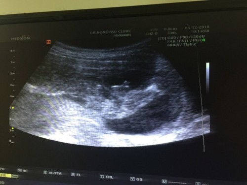 ซาวเพศ3เดือนครึ่ง เพศสามารถเปลี่ยนได้ไหม