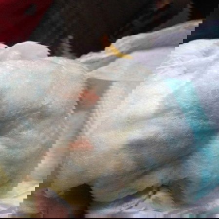 Mga mamsh, ano po kaya tong red stain sa diaper ng baby ko.