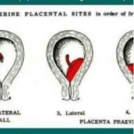 Placental sites