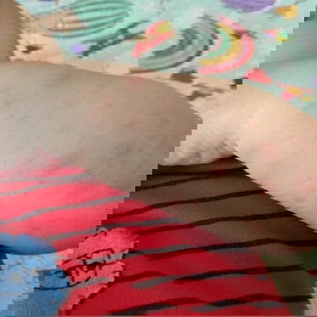 tangan merah merah