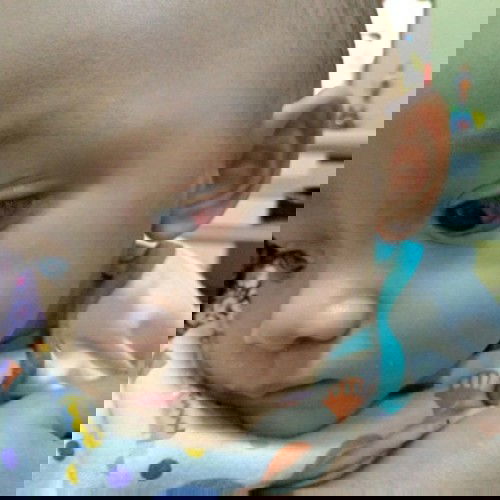 mata merah pada bayi