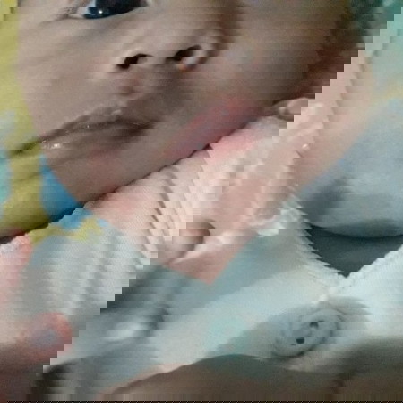 biang keringat/kemerahan