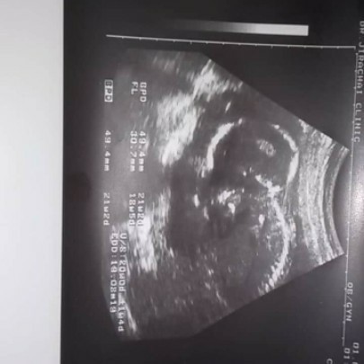 สอบถามแม่ๆหน่อยในกรณีที่หมอไม่ได้บอกน้ำหนักส่วนสูงของเด็ก