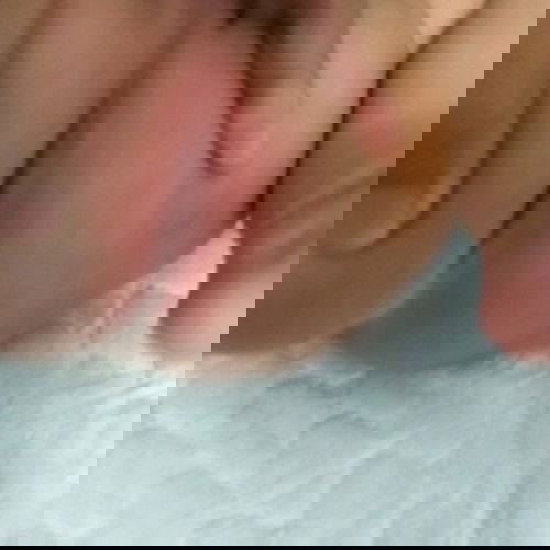 ผิวก้นลูกบวมแดง