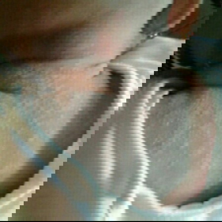 kulit sensitif