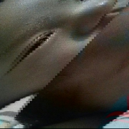 baby skin