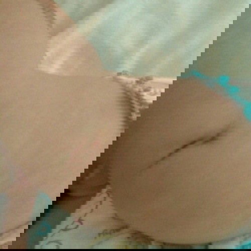 ลูกสะบ้าเข่าจม