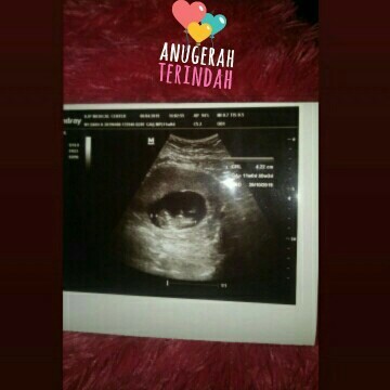 foto usg 11 week saya gmna dgn bunda2