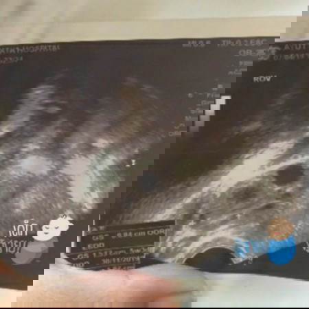 รักแรกพบ