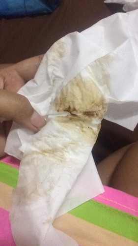 ใครเคยเป็นหลังตรวจภายในบ้างคะ