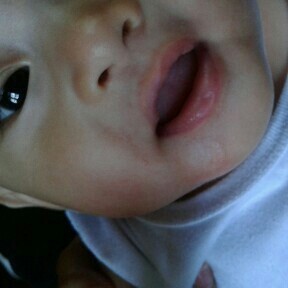 Baby