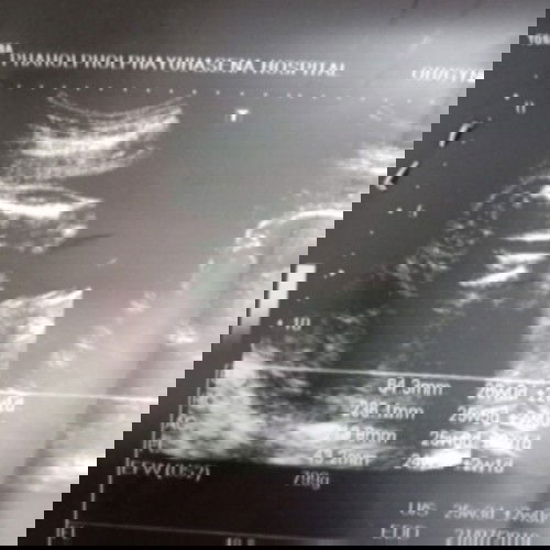 ช่วยดูเพศหน่อยจร้า