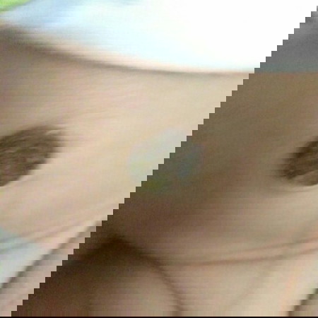 สะดือลูกเปนแบบนี้อันตรายรึป่าว