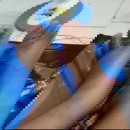 bengkak