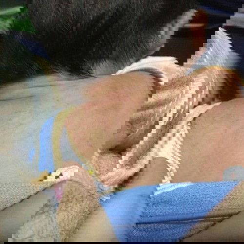 น้องเป็นผดผื่นขึ้นตามหลังคอข้อพับ