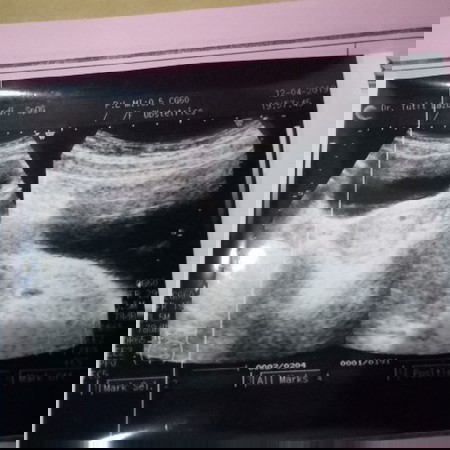 hamil 5 minggu