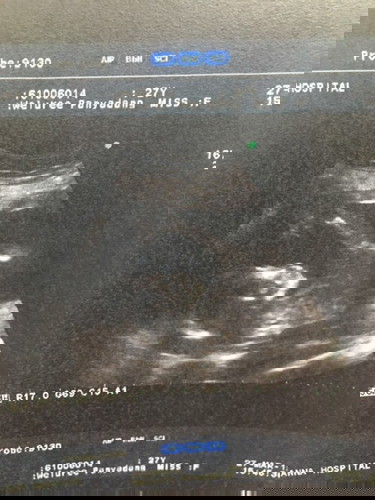 แม่ๆบ้านไหนลูกซนแบบนี้บ้างค่ะ