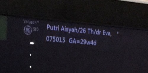 Umur kandung di apps dan usg