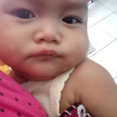bercak putih pada bayi