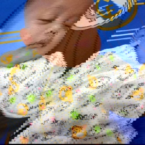 bintik2 pada pipi bayi 2bulan