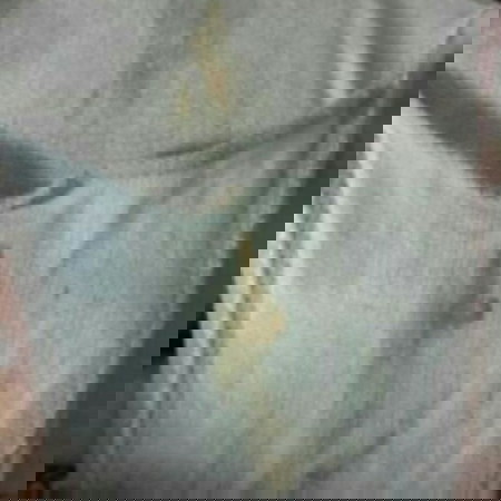 แบบนี้ใช่มูกเลือดรึเปล่าคะ