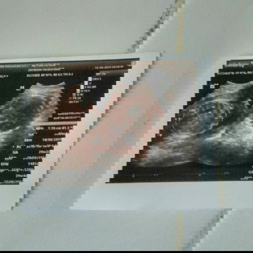 saya memasuki usia kandungan 29minggu