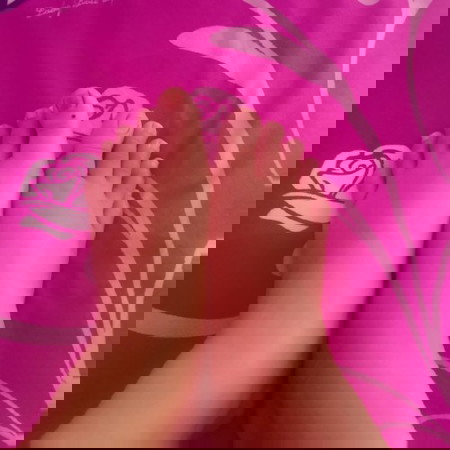 Kaki bengkak