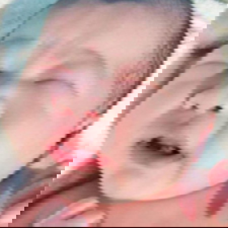 แชร์ประสบการณ์...ฟันแถม