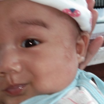 bintik2 merah diwajah