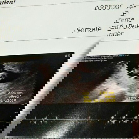 ท้อง10วีครู้สึกท้องน้อยกะตุก