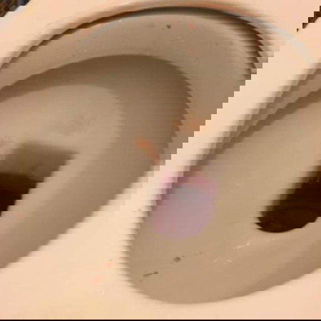 เลือดออกตอนท้อง9เดือนนี่คือไรคะแม่ๆใครรู้บอกที?