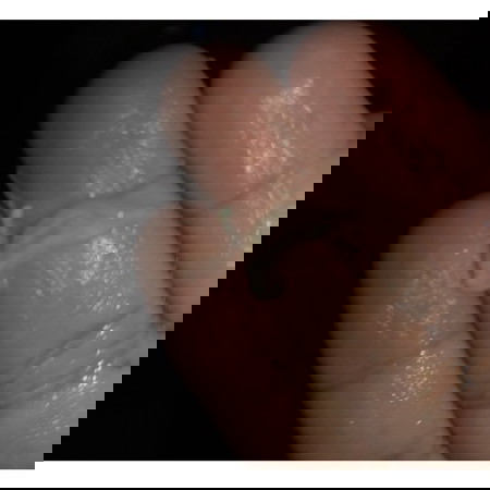 ท้อง 5 เดือนกว่า