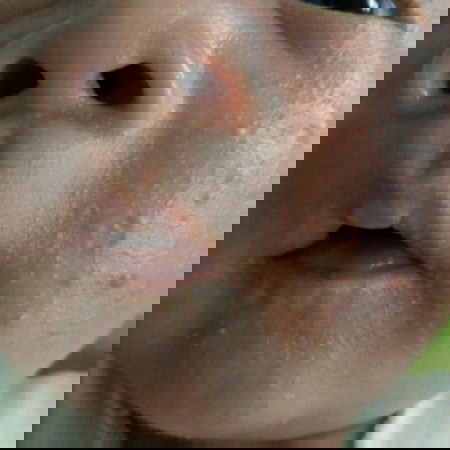 bintik merah