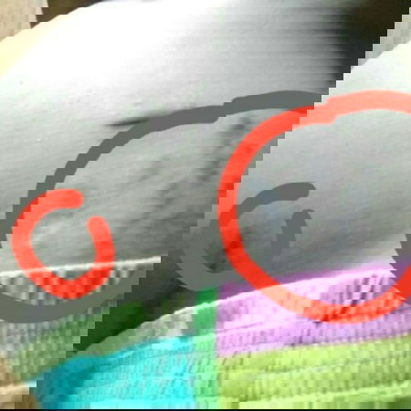 จุดสีดำ