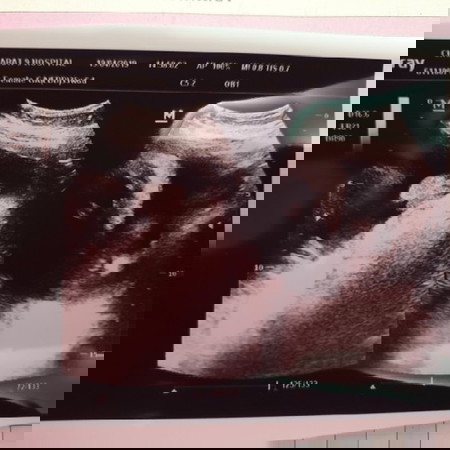 หมอนัดเมื่อวาน บอกว่า 9เดือนแล้วค่ะ ตอนนี้น้องหนัก3250gแล้วค่ะ