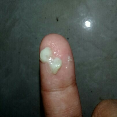 lendir kental seperti ingus