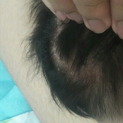 รักษายังไงดีคะ