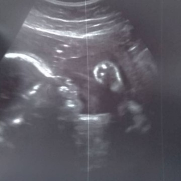 ครบ7เดือนวันนี้แล้ว 21/04/62