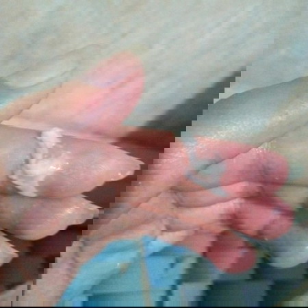 สันสนค่ะ