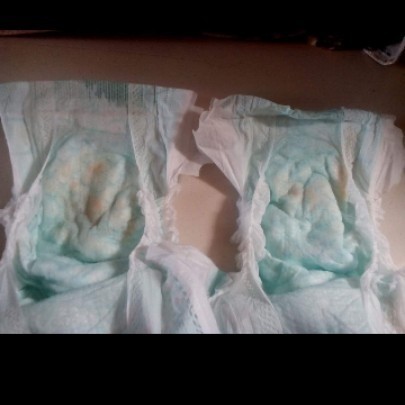 orange stain sa diaper