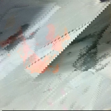 เลือดออก มีใครเคยเป็นแบบนี้ไหมคะ