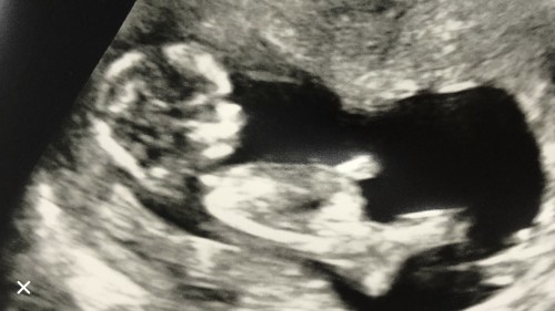 3-4 เดือน ค่ะ.