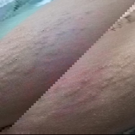 Skin Problem