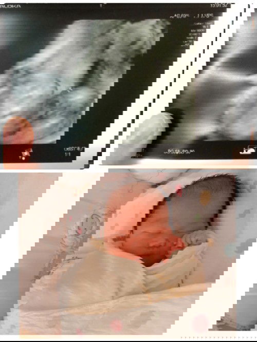 ภาพอัลตร้าซาวด์