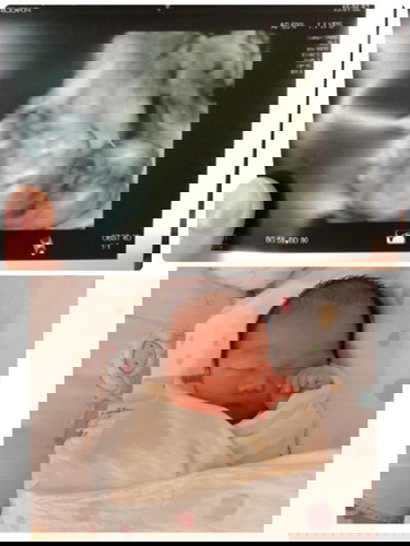 ภาพอัลตร้าซาวด์