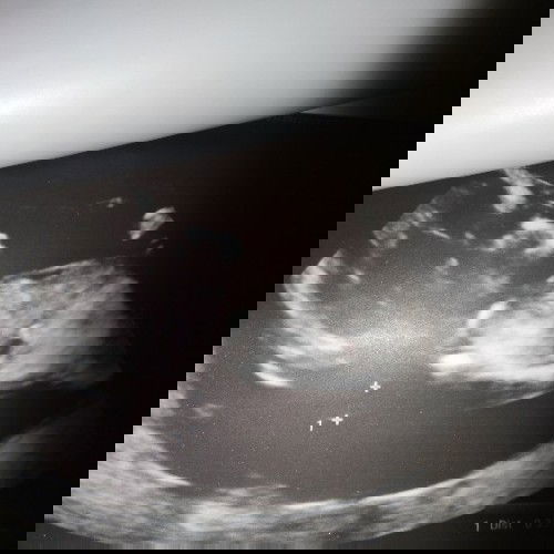 nakita manas kay baby